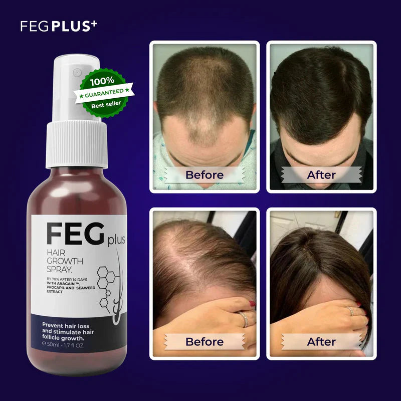 FEG HAIR GROWTH SPRAY | VISIBLE GROWTH IN 15 DAYS